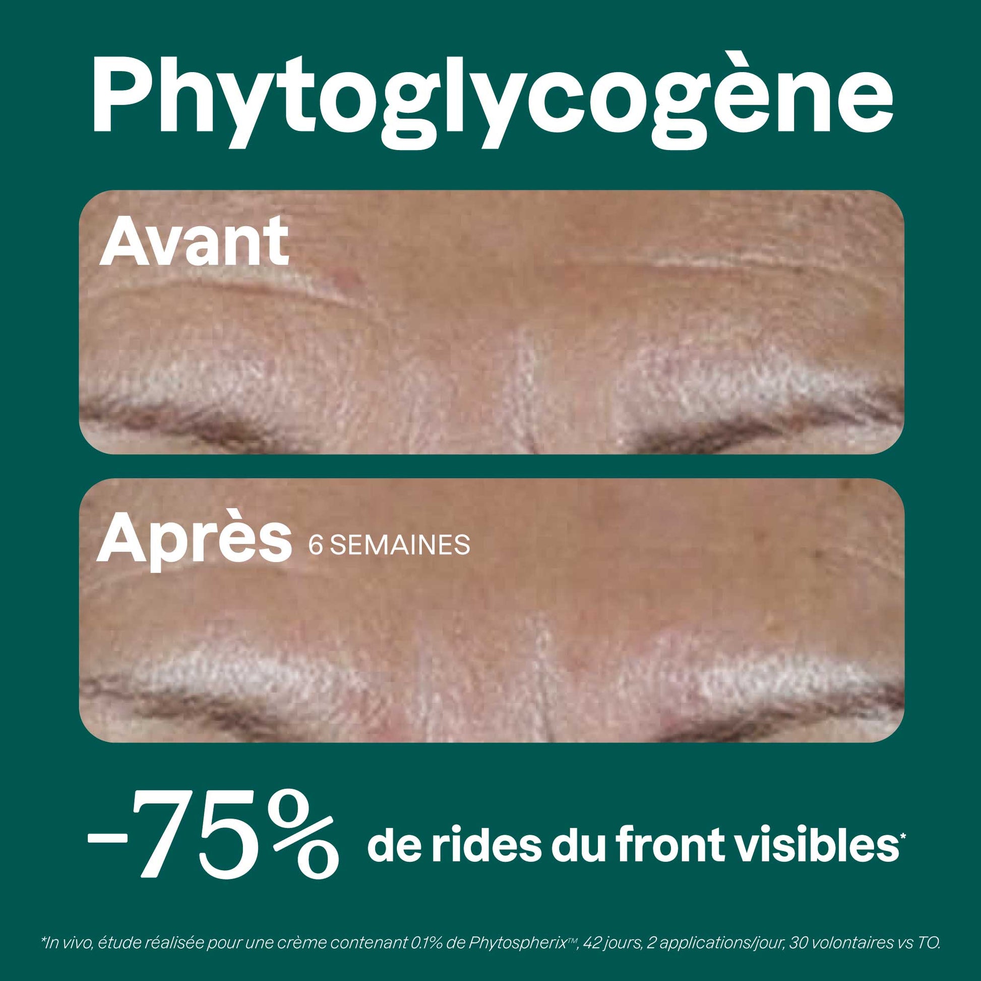 Phytoglycogene Before-after FR